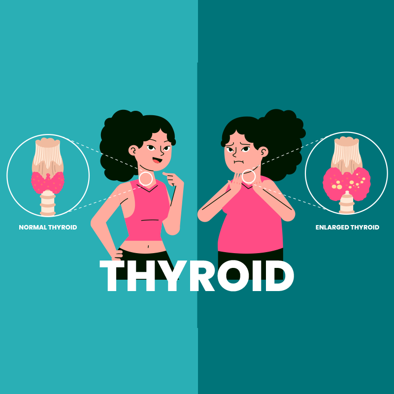 Thyroid Disorders: Unraveling the Mysteries